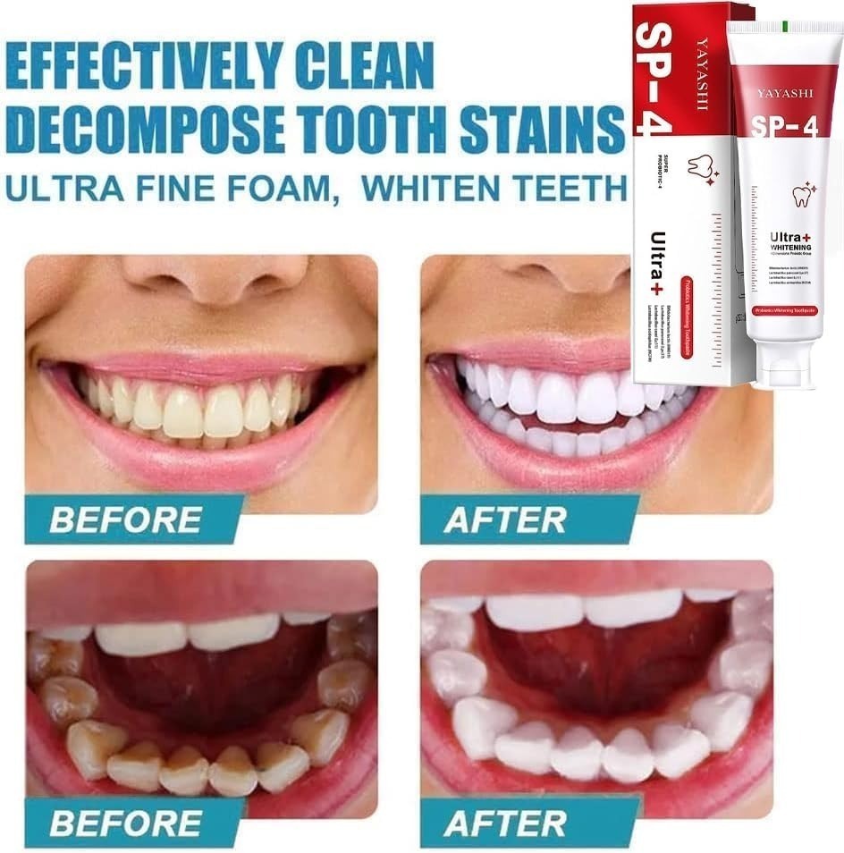 Premium YAYASHI SP-4 Ultra Whitening Probiotic Toothpaste –