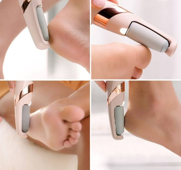 Electric Foot Callus Remover